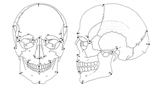 Illustration for article titled Ancestry, Race, and Forensic Anthropology